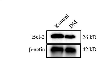 Şekil 2: Kontrol grubu ve Diyabet grubu testis dokusunda Bcl-2 ekspresyonu düzeyleri.