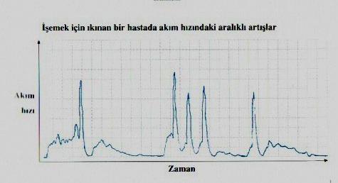 Hastayı