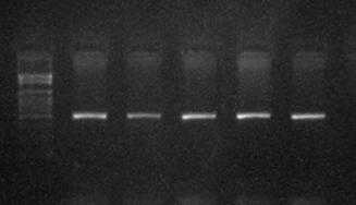 30 3.3.1.5. Agaroz jelin hazırlanışı PZR ürünün boyutuna göre %2,5 luk jel için 1,25 g agaroz (Sigma, A5093-5006) tartılarak 200 ml lik erlen içerisine eklendi.