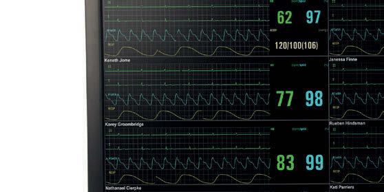 Monitörizasyon Sistemi (CMS), Vista 120/Vista 120 S