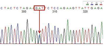 148 ġekil 3.5: κ-kazein ekzon bölgesi DNA dizisi, 443. nükleotiddeki SNP Şekil 3.5 de görüldüğü gibi üçüncü SNP, 443. nükleotidde, GAT GCT şeklinde polimorfizm tespit edilmiştir.