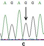 varyasyonlar, a)-309 A/G heterozigotlar, b)-309 A/A homozigotları, c) G/G homozigotları Yine sadece bir kişinin