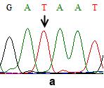 G γ geninde -567 lokasyonlu T/T homozigot (a) ve T/G heterozigot (b) varyasyonları G γ promotör bölgesinde incelenen mutasyonlar,