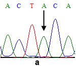 heterozigotları ve c)-499 A/A homozigotları A γ geni promotör bölgesi -588