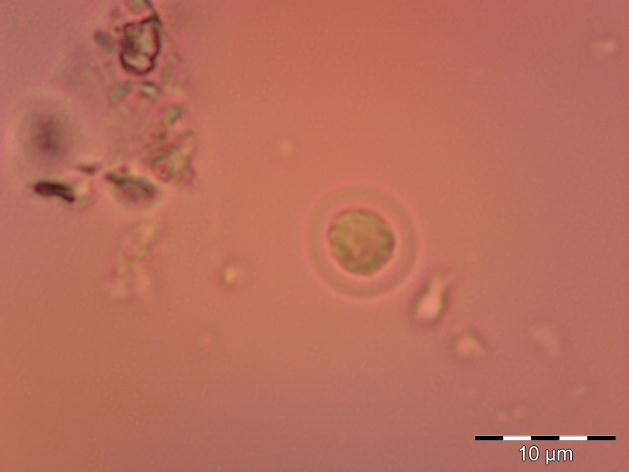 4.Tür: Chroococcus minor (Kützing) Nägeli (Şekil 3.6, Şekil 3.7) ġekil 3.6: Chroococcus minor (Kützing) Nägeli ġekil 3.