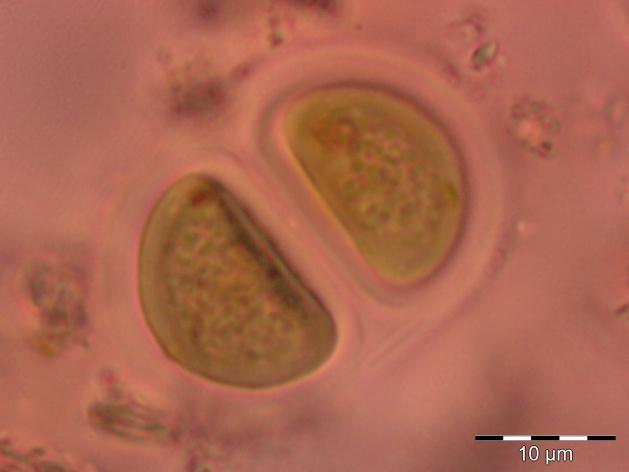 ġekil 3.8: Chroococcus turgidus (Kützing) Nägeli ġekil 3.