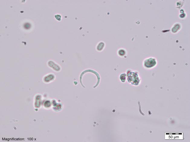 ġekil 3.11: Dactylococcopsis raphidioides Hansgirg 4.Cins: Marssoniella E.Lemmermann 7.Tür: Marssoniella elegans Lemmermann (Şekil 3.