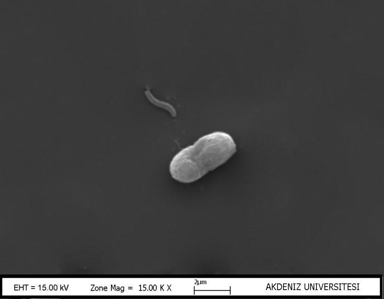 ġekil 3.15: Cyanobacterium cedrorum (Sauvageau) Komárek, Kopecky & Cepák ġekil 3.