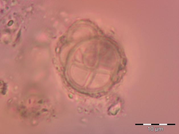 21.Tür: Chroococcidiopsis thermalis Geitler (Şekil 3.33) Tanımlayıcı özellikleri: Hücreler küresel şekilli, nadiren tek halde bulunurlar. İnce ve renksiz bir kılıf bulunur.