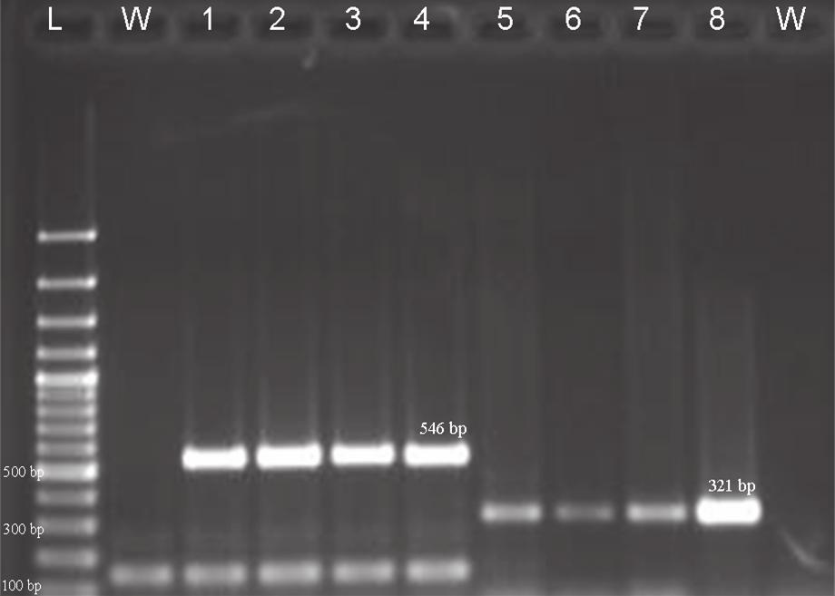 DETECTION OF VIRUSES IN AEGEAN REGION GRAPEVINES Şekil 3. GLRaV-3 ve GFLV için uygulanmış olan RT-PCR testi sonucunun jel görüntüleme sisteminde çekilmiş fotoğrafı.