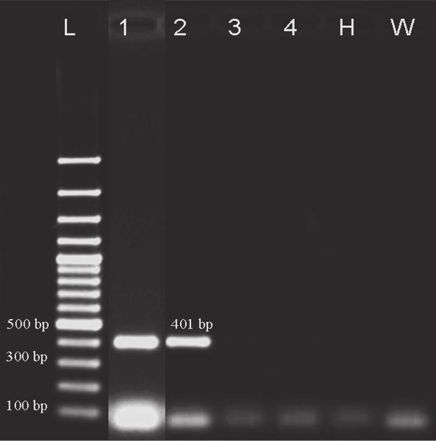 büyüklüğünde DNA bantları elde edilmiştir (Şekil 6).