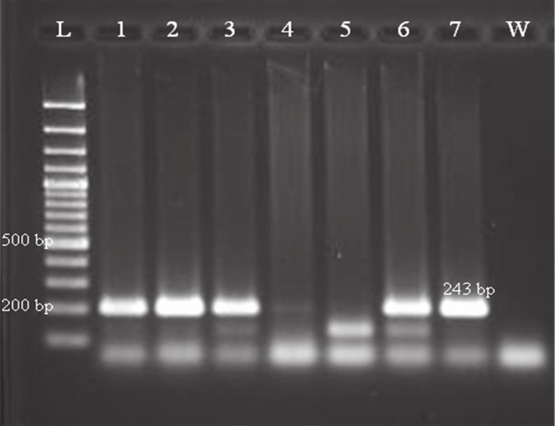 nested PCR ve Real Time PCR yöntemleri kullanılmaktadır (Gugerli et al. 1984, Rowhani 1992, Habili et al. 1992, Boscia et al. 1997, Acheche,et al., 1999, Digiaro et al. 2000, Rowhani et al.