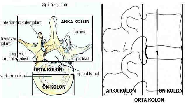 2.9. SINIFLANDIRMA YÖNTEMLERĐ Torakolomber kırıklarla ilgili hali hazırda etiopatogenezi açıklayan, tedaviye yol gösteren ve prognoz hakkında bilgi veren evrensel bir sınıflama yapılamamıştır.