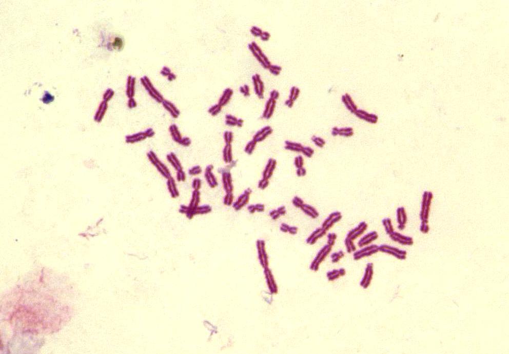 3.MATERYAL VE METOD 10 µm Şekil 3.4.