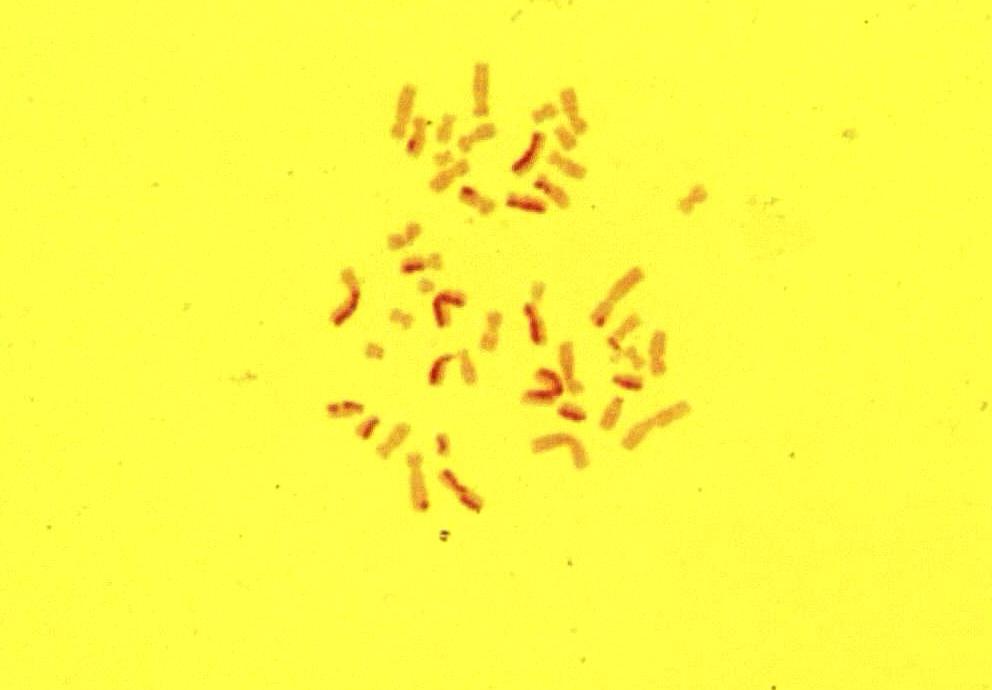 3.MATERYAL VE METOD 10 µm Şekil 3.6.Üçüncü mitoz bölünmeyi geçiren hücreye ait kromozomlar.