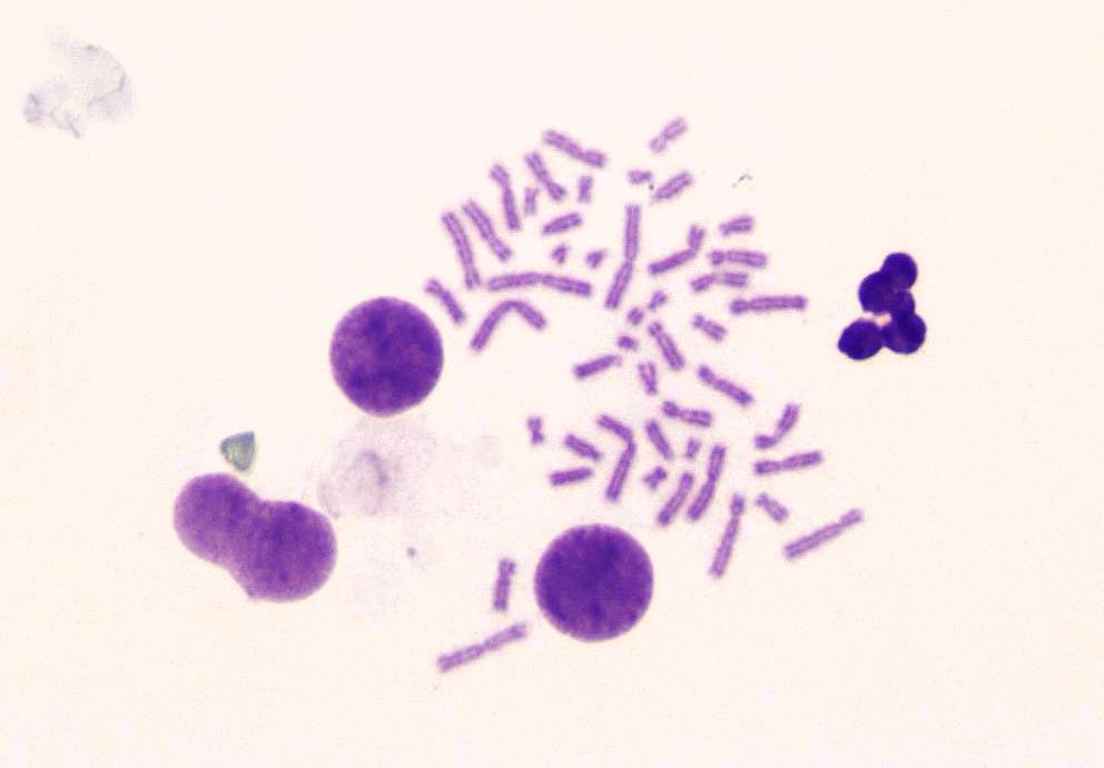 4.BULGULAR VE TARTIŞMA 10 µm Şekil 4.9.