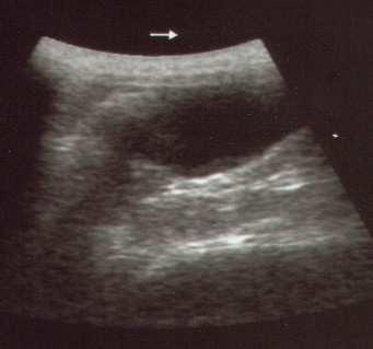 Yirmisekizinci günde abortus amacıyla Cabergolin+PGF2α uygulanan bir adet köpekte abortusu izleyen 24.