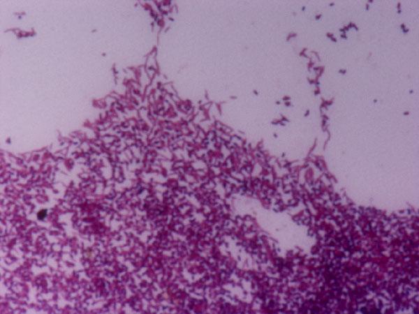 Flavobacterium columnare (Şekil 4.