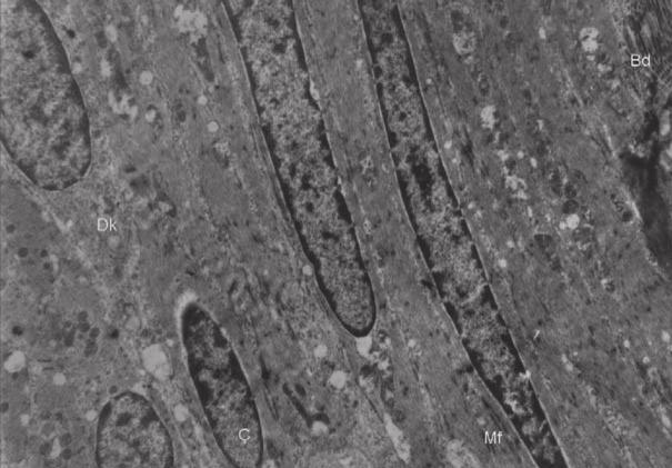 Kontrast saðlamak için alýnan kesitler, uranil asetat ve kurþun sitrat ile boyanarak Carl Zeiss EM 900 elektron mikroskopta deðerlendirilerek resimlendirildiler.