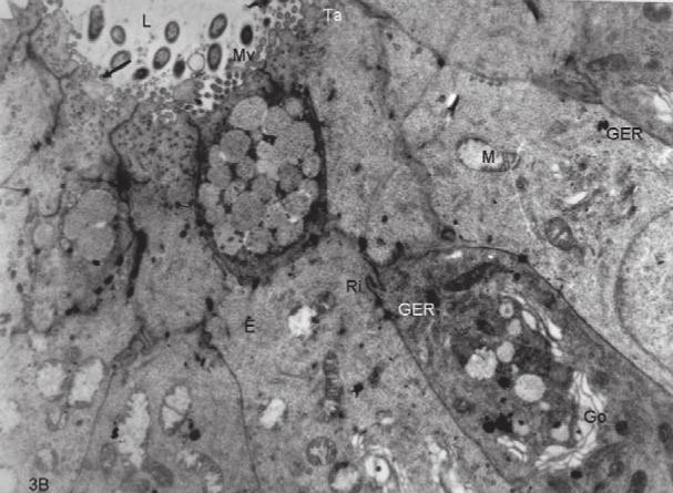 normaldi. Emilim yapan hücrelerde çizgili kenar oldukça belirgindi (Resim 3A). Ayný grubun elektron mikroskop incelemelerinde terminal aðda belirgin bir düzensizlik görülüyordu.