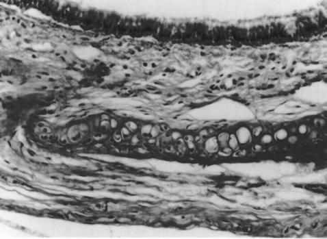 oksidatif stres sonucunda makrofajlarda apoptozisin arttığı ve bu apoptozisin glutatyon, askorbik asit ve alfa-tokoferol gibi anti-oksidanlar tarafından inhibe edildiği bildirilmektedir (4).