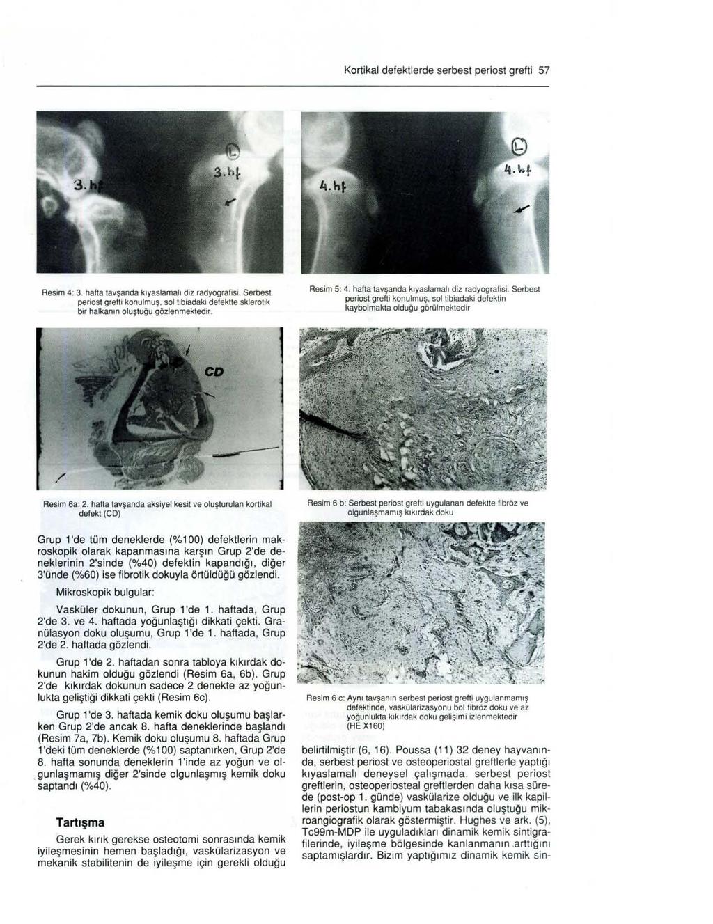 Kortikal defektierde serbest periost grefti 57 Resim 4: 3. hafta lavşanda k ı yaslamalı diz radyografisi.