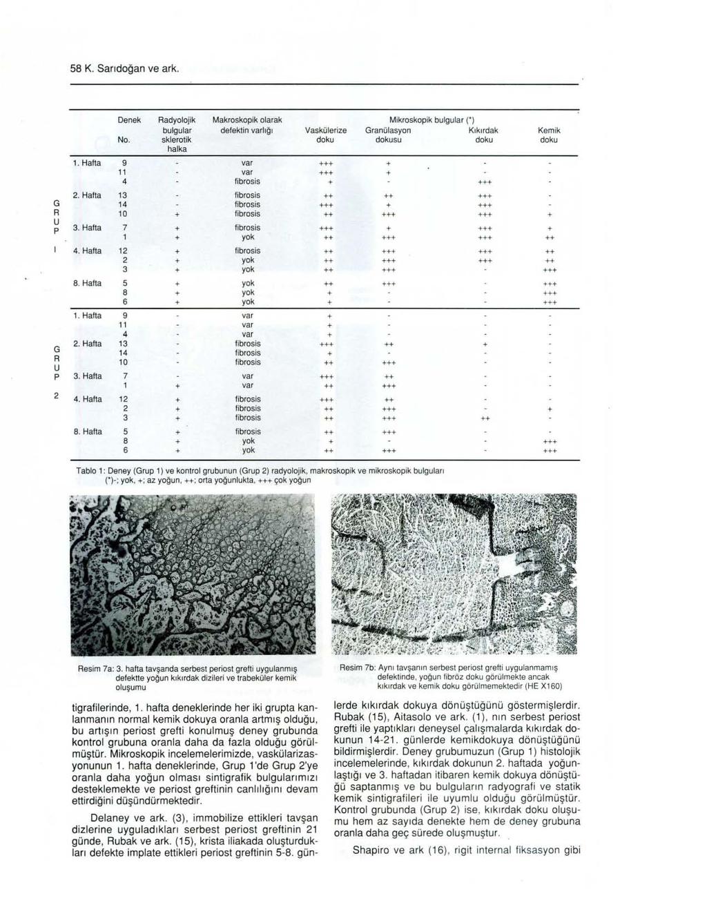 58 K. Sarıdoğan ve ark. Denek Radyolojik Makroskopik olarak Mikroskopik bulgular n bulgular defektin va rlığı Vaskülerize Granülasyon Kıkırdak Kemik No. skleratik doku dokusu doku doku halka 1.