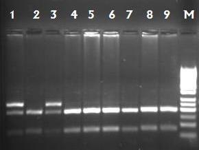 64 Elde edilen bu PCR karışımından 0,2 ml lik tüplere 17 µl, bakteri DNA sından da 3 µl dağıtılarak termal döngü cihazına (BIONEER termal cycler, Kore) yerleştirildi.
