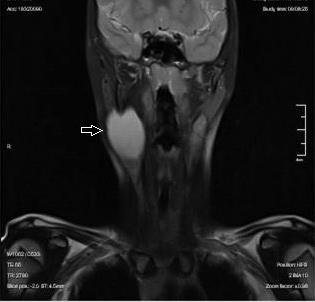 Boyun kitlelerinin ilk olarak ultrasonografi ile değerlendirilmesi, kitlenin solid veya kistik yapıda olup olmadığı, doppler ultrasonografi ise damarlanması ve büyük boyun damarlarına komşuluğunun