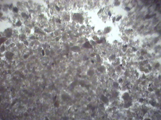 taneciklerin optik mikroskoptaki görüntüsü 5µm