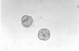 8 µm) Şekil 11. Echium spp. (1 cm=13.8 µm) Şekil 12. Mespilus spp. (1 cm= 13.