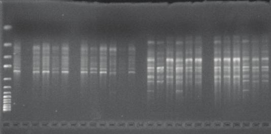 28 ekil 4.2: Çe itli oranlarda seyreltilmi baz örnek DNA lar n n seyreltme denemesi jel görüntüsü ekil 4.