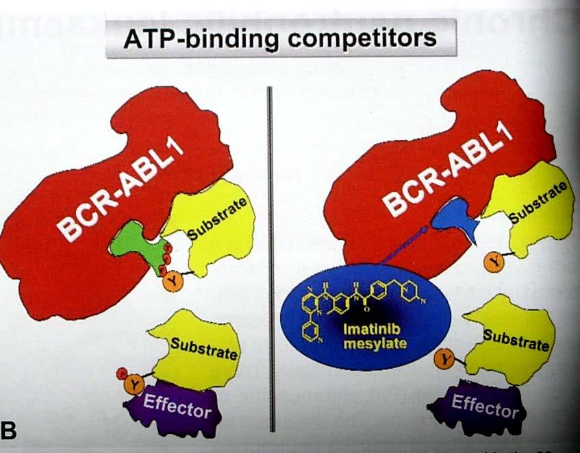 Kronik Myeloid Lösemi Tedavi Imatinib mesylate, tirozin kinaz sisteminin sürekli aktive olmasına yol açan bcr-abl molekülünün ATP bağlayan
