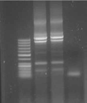10: Birer tane P1 ve P2 motifi, 2 tane P3 motifi içeren 3 no lu örnek). Şekil 2. Klonlanan rekombinant caga fragmentinin PCR ile amplifikasyonu sonrası %1 lik agaroz jel görüntüsü. mıştır (Şekil 3).