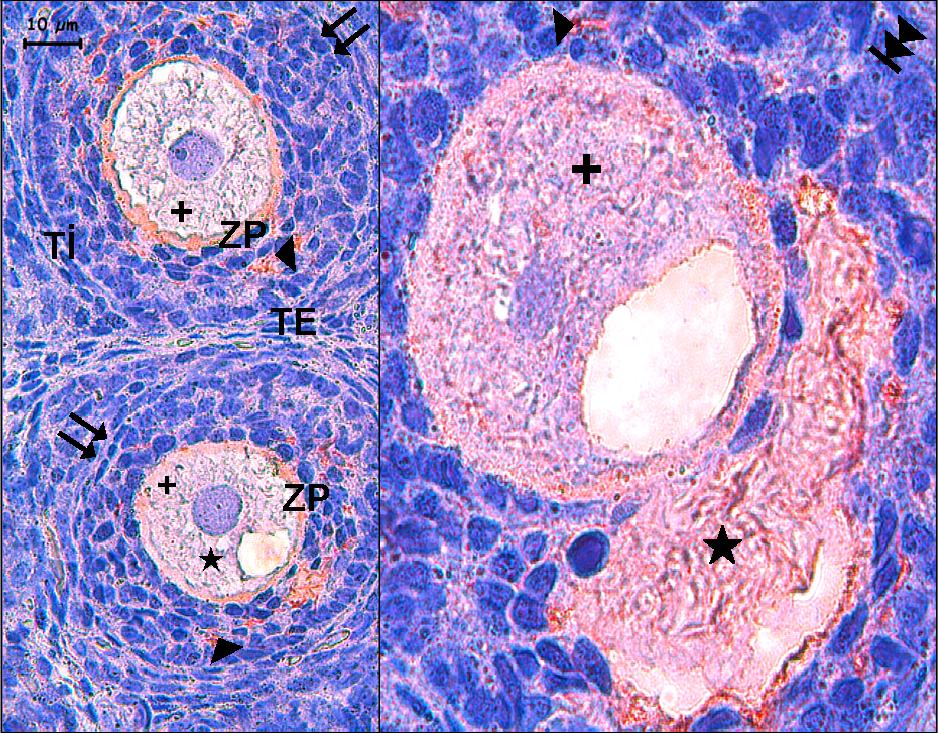 çekiyor; primordiyal follikül ( ), tek katlı ( ) ve çok katlı (,) primer follikül ve antral follikül ( )