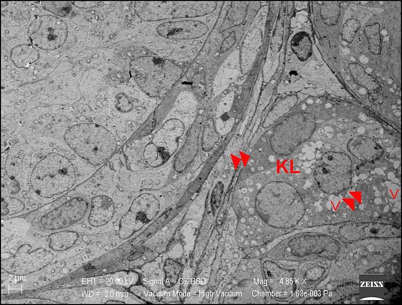 resimlerde; oosit sitoplazması (+), zona pellusida (ZP), granüloza