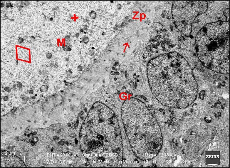sitoplazmasında (+) tubüller ( ) ve mitokondriyon (M), granüloza