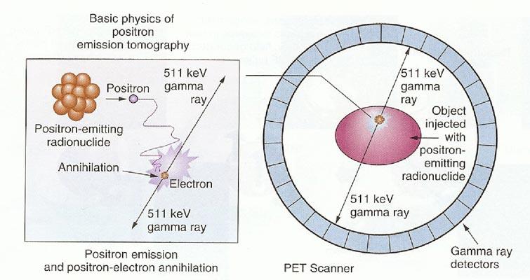 Positron Emisyon Tomografisi Patolojik dokuda metabolizma değişikliği Pozitron emisyonu yapan radyoaktif molekül Molekül