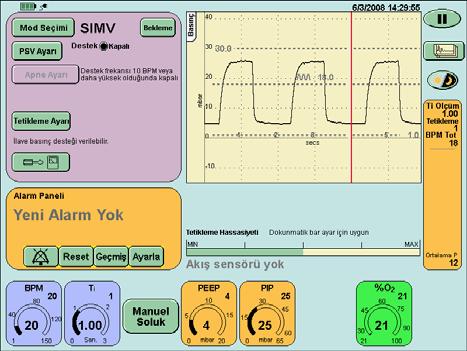 Adım 33. Mod Seçim panelinden SIMV yi seçin, ama onay düğmesine BASMAYIN. Adım 34. e ilerleyin.