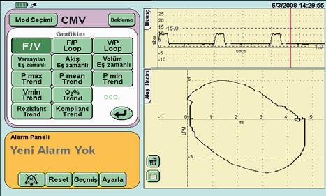 11.2 Çevrimler Ventilatörde aşağıdaki üç çevrim görüntülenir: akış - hacim, akış - basınç ve hacim - basınç. Ventilatör, pencereyi yenilemeden önce üç çevrim çizer.