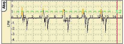 Eşiğin ayarlandığı seviye, ventilatörün solunum olarak neyi tanımlayacağını ayarlar.