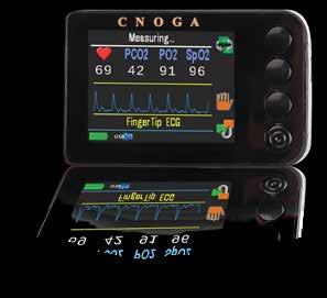 INR Cihazı CoaguChek Matrix (MTX) Cihazı v Cnoga Medical Kablosuz EKG Sistemi Spyder Ölçebildiği Parametreler : Nerede olursanız olun ve ne zaman olursa olsun, kan sulandırıcı tablet Coumadin