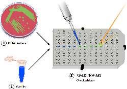 MALDI TOF MS (Matrix