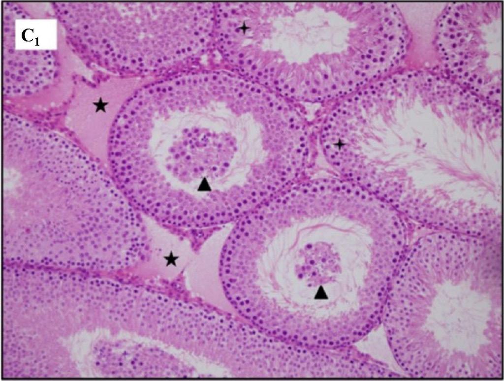4 germinal epitelde ve seminifer tübül bazal membranında düzensizlikler, interstisyel alanda ödem gözlendi (Resim 3, 4).