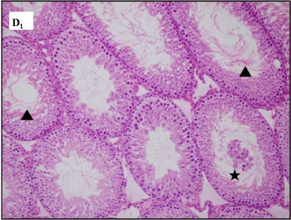 MTX+PS grubuna ait testis kesiti görüntüsü, lümende spermatoza yoğunluğu ( ) ve az sayıda lümende olgunlaşmamış germinal hücrelerin görüldüğü seminifer tübüller ( ) izlenmektedir (D2; H&E, X200,