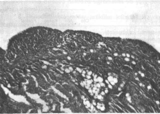 rol haftalarında elde edilen histolojik bulgular Tablo 3'de sunuldu. Tablo 3'de görüldüğü gibi, otogreft grubunda 1., 2. ve 4.