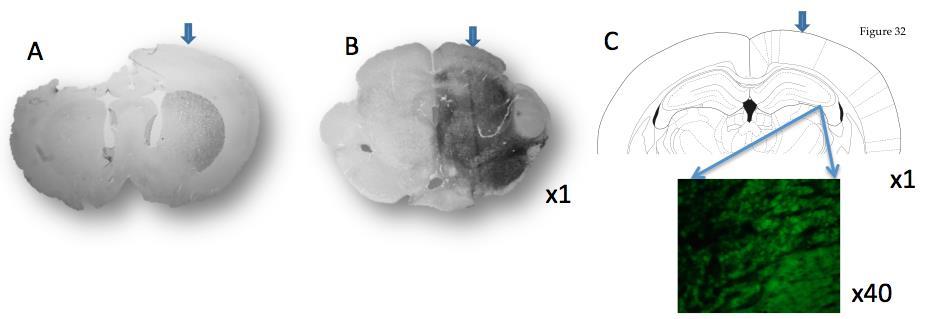 hipokampus. Striatum (A ve D) ve substansiya nigra (B ve E) yapılarında alfa-sinüklein in enjeksiyon tarafında (ok ile işaretli) intakt tarafa kıyasla daha fazla ifade edildiği görülmektedir.