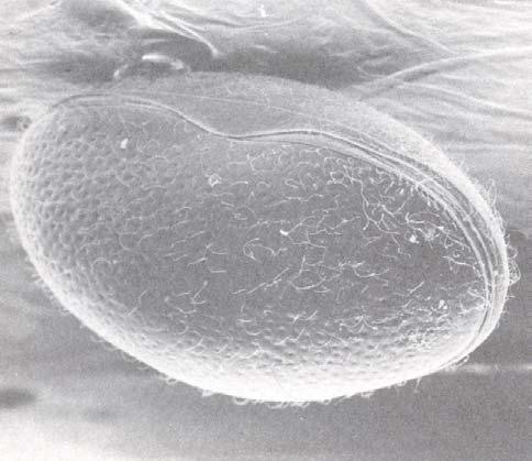 199 Şekil 1.3. Ostracod lardan Cypridopsis vidua türünün SEM görüntüsü (Henderson, 1990 dan) Büyük ölçüde körelmiş olan başta dört çift ekstremite bulunur.