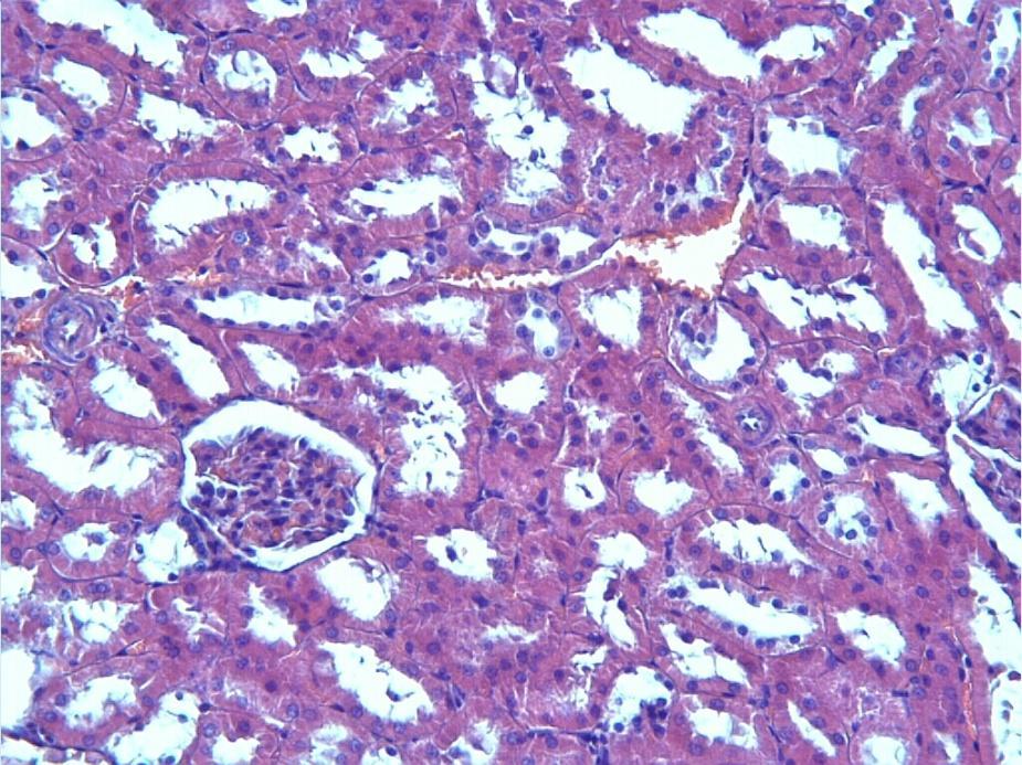 Resim 22. Diyabet + Melatonin grubu; hafif tubuler epitelyal dökülme ve bazı tubul hücrelerinde hidropik değişiklikler görülmekte (oklar). H-E; X20. Bu grupta peritubuler inflamasyona rastlanmadı.