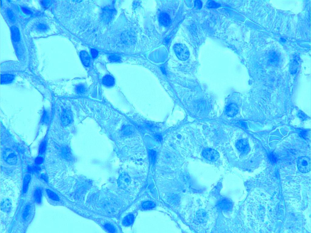 Resim 24. Diyabet + Melatonin grubu; mavi renkte boyanan granüller seyrek olarak görülmekte (oklar). Toluidin mavisi; X100.